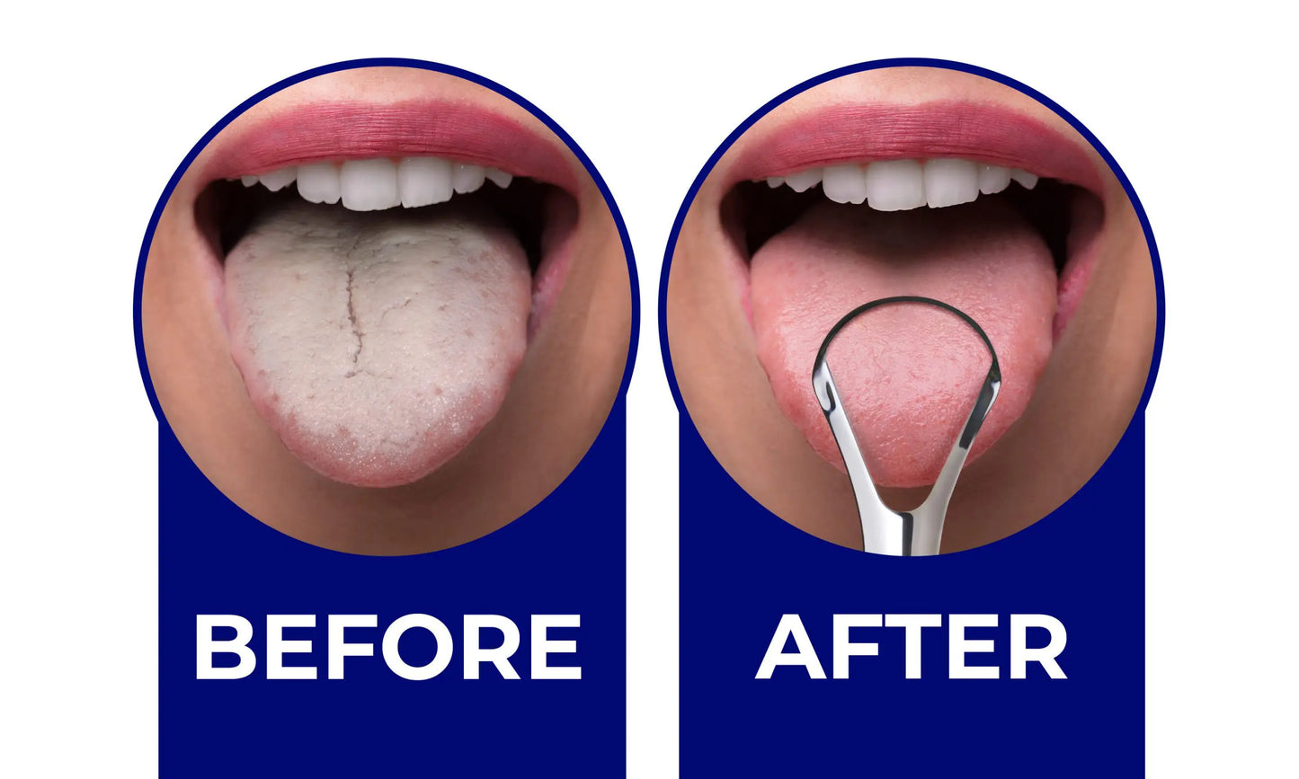 Tongue Scraper (3pcs)